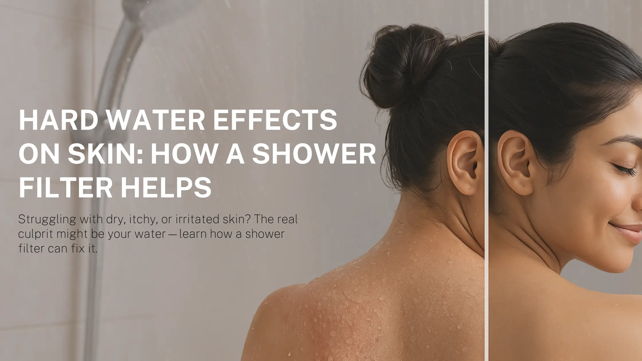 Hard Water Effects on Skin